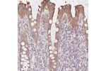 Immunohistochemical staining of human rectum shows moderate cytoplasmic positivity in glandular cells.