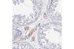 Immunohistochemical staining of human liver shows moderate membranous positivity in hepatocytes.