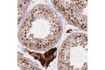 Immunohistochemical staining of human testis shows strong nuclear positivity in cells in seminiferus ducts.
