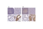 Immunohistochemical staining of human lymph node, pancreas, prostate and testis using Anti-CSE1L antibody HPA038059 (A) shows similar protein distribution across tissues to independent antibody HPA038060 (B).