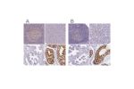 Immunohistochemical staining of human lymph node, pancreas, prostate and testis using Anti-CSE1L antibody HPA038060 (A) shows similar protein distribution across tissues to independent antibody HPA038059 (B).