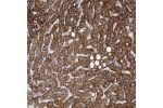 Immunohistochemical staining of human liver shows strong granular cytoplasmic positivity in hepatocytes.