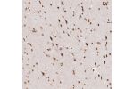 Immunohistochemical staining of human cerebral cortex shows strong nuclear positivity in neurons and glial cells.