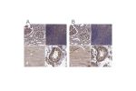 Immunohistochemistry analysis in human skeletal muscle and liver tissues using Anti-MAP4 antibody. Corresponding MAP4 RNA-seq data are presented for the same tissues.