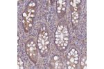 Immunohistochemical staining of human rectum shows moderate cytoplasmic positivity in glandular cells.