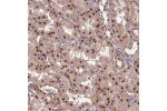 Immunohistochemical staining of human kidney shows strong nuclear positivity in renal tubules.