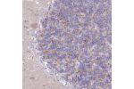 Immunohistochemical staining of human cerebellum shows moderate cytoplasmic positivity in cells in granular layer.