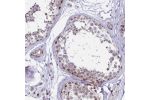 Immunohistochemical staining of human testis shows weak to moderate nuclear and nucleolar positivity in cells in seminiferous ducts.