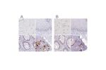 Immunohistochemical staining of human cerebral cortex, esophagus, rectum and soft tissues using Anti-ACAN antibody HPA038241 (A) shows similar protein distribution across tissues to independent antibody HPA038242 (B).