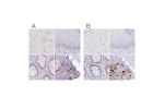 Immunohistochemical staining of human cerebral cortex, esophagus, rectum and soft tissues using Anti-ACAN antibody HPA038242 (A) shows similar protein distribution across tissues to independent antibody HPA038241 (B).
