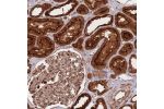 Immunohistochemical staining of human kidney shows strong cytoplasmic and membranous positivity in cells in tubules.