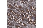 Immunohistochemical staining of human duodenum shows strong granular cytoplasmic positivity in glandular cells.