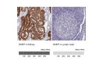 Immunohistochemistry analysis in human kidney and lymph node tissues using HPA038285 antibody. Corresponding BHMT RNA-seq data are presented for the same tissues.