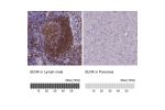 Immunohistochemistry analysis in human lymph node and pancreas tissues using Anti-BLNK antibody. Corresponding BLNK RNA-seq data are presented for the same tissues.