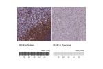 Immunohistochemistry analysis in human spleen and pancreas tissues using Anti-BLNK antibody. Corresponding BLNK RNA-seq data are presented for the same tissues.