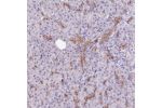 Immunohistochemical staining of human pancreas shows strong membranous positivity in exocrine glandular cells.