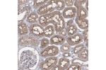 Immunohistochemical staining of human kidney shows membranous and cytoplasmic positivity in cells in tubules.