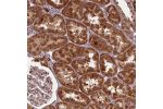Immunohistochemical staining of human fallopian tube shows mdoerate cytoplasmic positivity in glandular cells.