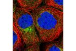 Immunofluorescent staining of human cell line A-431 shows localization to nucleoplasm & vesicles.
