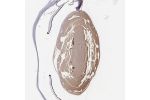Immunohistochemical staining of human eye shows moderate positivity in lens.