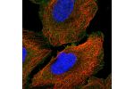 Immunofluorescent staining of human cell line U-2 OS shows localization to plasma membrane.