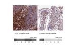 Immunohistochemistry analysis in human lymph node and small intestine tissues using HPA038494 antibody. Corresponding CD3G RNA-seq data are presented for the same tissues.