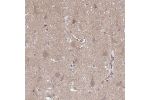 Immunohistochemical staining of human cerebral cortex shows neuropil and cytoplasmic positivity in neurons.