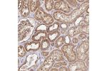 Immunohistochemical staining of human kidney shows strong cytoplasmic positivity in cells in tubules, cells in glomeruli were moderately stained.