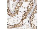 Immunohistochemical staining of human testis shows strong cytoplasmic positivity in cells in seminiferus ducts.