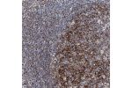 Immunohistochemical staining of human tonsil shows strong cytopplasmic positivity in germinal center and non-germinal center cells.