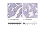 Immunohistochemistry analysis in human fallopian tube and prostate tissues using Anti-C11orf70 antibody. Corresponding C11orf70 RNA-seq data are presented for the same tissues.
