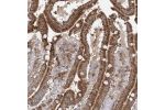 Immunohistochemical staining of human duodenum shows strong cytoplasmic positivity in glandular cells.