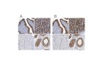 Immunohistochemical staining of human fallopian tube, gastrointestinal, skeletal muscle and testis using Anti-PTGES3 antibody HPA038672 (A) shows similar protein distribution across tissues to independent antibody HPA038673 (B).