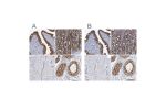 Immunohistochemical staining of human fallopian tube, gastrointestinal, skeletal muscle and testis using Anti-PTGES3 antibody HPA038673 (A) shows similar protein distribution across tissues to independent antibody HPA038672 (B).