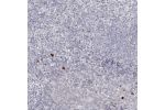 Immunohistochemical staining of human tonsil shows strong cytoplasmic positivity in a small subset of lymphoid cells.