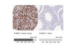 Immunohistochemistry analysis in human heart muscle and testis tissues using HPA038736 antibody. Corresponding ANKRD1 RNA-seq data are presented for the same tissues.