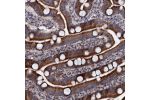 Immunohistochemical staining of human duodenum shows strong cytoplasmic positivity in glandular cells.