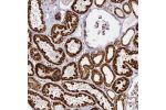 Immunohistochemical staining of human kidney shows strong granular cytoplasmic positivity in cells in tubules.