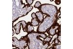 Immunohistochemical staining of human placenta shows strong cytoplasmic and membranous staining in trophoblasts.