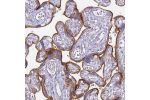 Immunohistochemical staining of human placenta shows strong membranous and cytoplasmic positivity in trophoblastic cells.