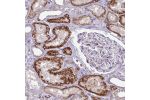 Immunohistochemical staining of human kidney shows strong cytoplasmic positivity in cells in tubules.