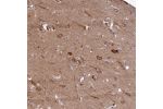 Immunohistochemical staining of human cerebral cortex shows moderate to strong cytoplasmic positivity in neurons.