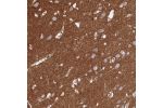 Immunohistochemical staining of human cerebral cortex shows strong membranous positivity in neuropil.