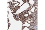 Immunohistochemical staining of human Lung shows strong membranous and cytoplasmic positivity in pneumocytes.