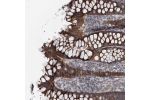 Immunohistochemical staining of human colon shows strong cytoplasmic positivity in glandular cells.