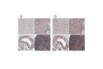 Immunohistochemical staining of human cerebral cortex, squamous epithelia, testis and tonsil using Anti-PSMD4 antibody HPA038807 (A) shows similar protein distribution across tissues to independent antibody HPA039252 (B).