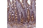 Immunohistochemical staining of human duodenum shows distinct cytoplasmic positivity in glandular cells.