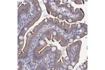Immunohistochemical staining of human colon shows moderate membranous positivity in glandular cells.