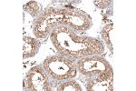 Immunohistochemical staining of human testis shows moderate membranous and cytoplasmic positivity in cells in seminiferous ducts.