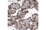 Immunohistochemical staining of human placenta shows strong membranous positivity in trophoblastic cells.